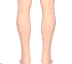 Orthopedic Sandals for Foot Support and Comfort